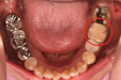 Case01　治療前の写真