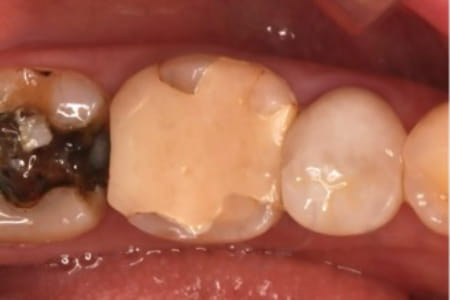 Case01　治療前のアップ写真