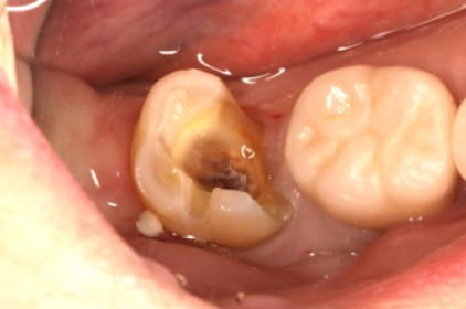 Case02　治療前の写真