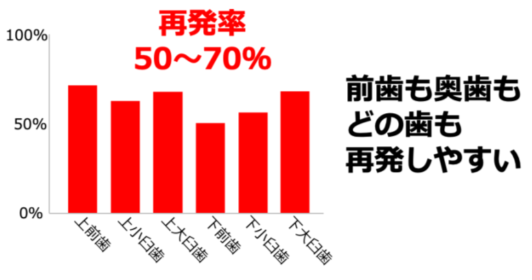 日本で根管治療を行えば高確率で失敗し、抜歯に近づく