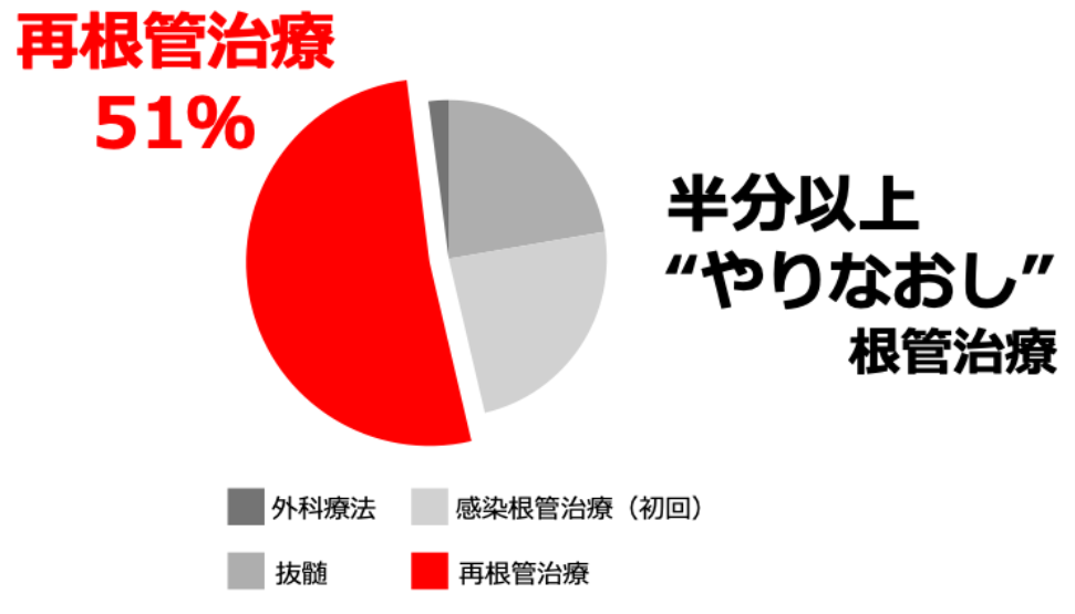 日本の根管治療は、“やりなおし”ばかり行っている