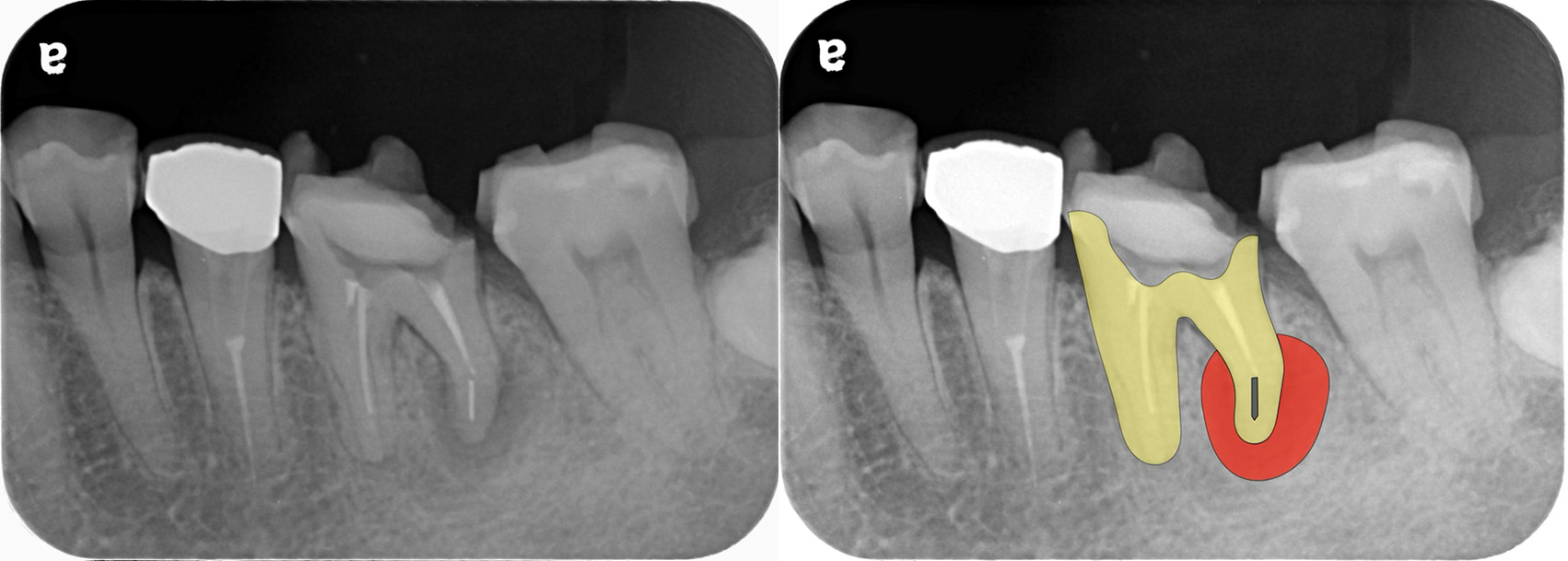 診査・診断・治療方針立案
