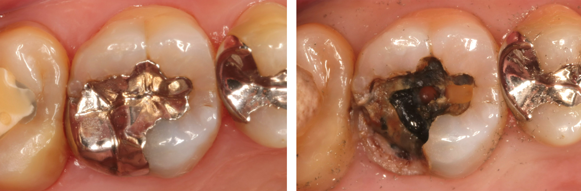 診査・診断・治療方針立案